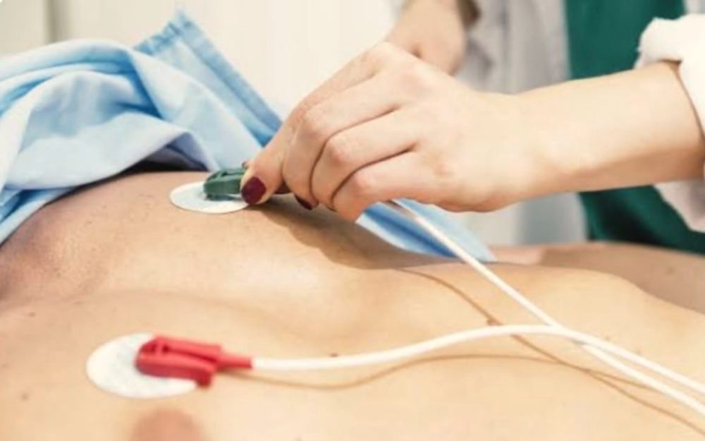 Eletrodos de eletrocardiograma sendo posicionados no tórax do paciente